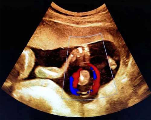 上海正规的代孕服务-孕期B超医生在肚子上涂的“透明胶体”是啥？知道后确实