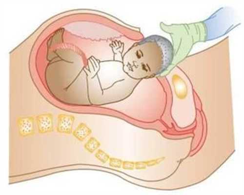 上海试管代孕妈妈需要体检那些-新生儿总胆汁酸高说明什么
