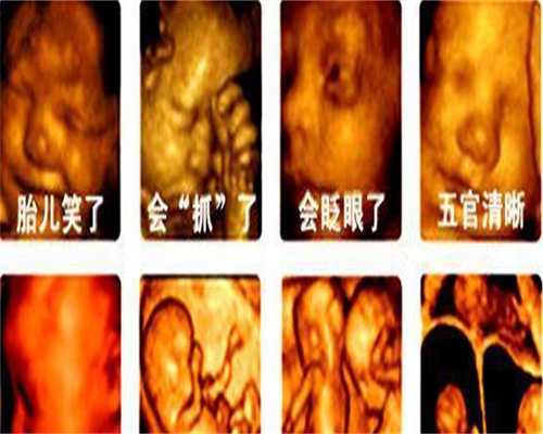 上海有合法的代孕医院么-油豆腐的热量