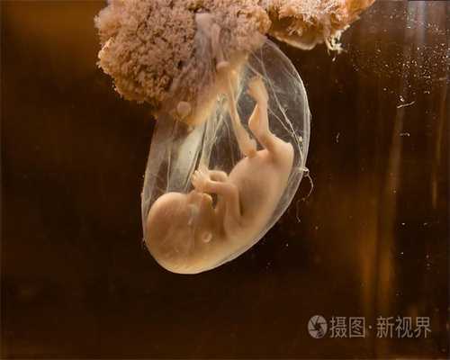 上海代孕怎么联系-输卵管阻塞