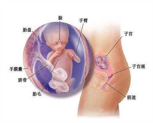 上海卵巢早衰可以找供卵代孕-产后小腹突出的原因 可能是骨盆前倾