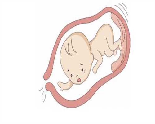 上海代孕需多少价格-哪些胎儿缺陷B超检查不出来？