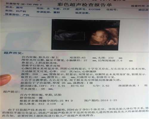 上海有做过代孕的-助产方式有哪些