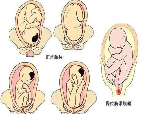 上海医院有做代孕没-高龄生育存在一定的风险，生孩子要趁早！