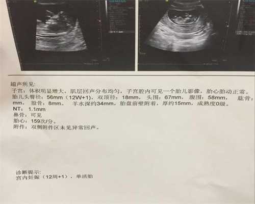 上海代孕产子的流程是-辅助生殖检查项目有必要做吗？这些检查都有哪些作用