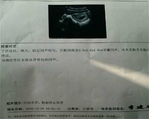 上海切除子宫可代孕吗-产后第一次同房要注意的事情有哪些