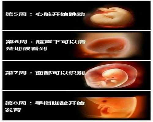 上海15万包成功代孕价格-孕妇能吃雪糕吗，孕妇吃零食应注意什么