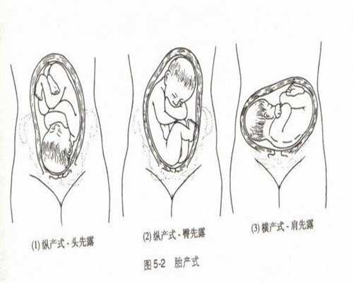 上海代孕成功率能有多少-妊娠脂肪肝症状有哪些