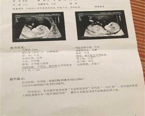 上海代孕代孕产子价格及流程_上海哪有愿意代孕的个人