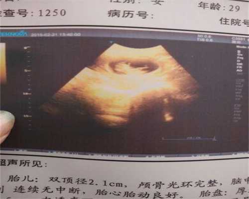 上海代孕什么费用_上海hiv代孕流程