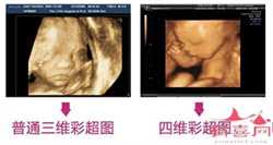 上海哪里需要代孕_52岁绝经了怎么做试管_试管婴儿隐患_隐藏在婴儿床里的7大隐