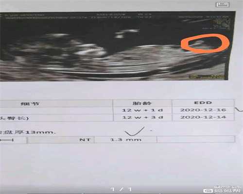 找个代妈生小孩可以吗_代孕费用多少_试管婴儿胚胎鉴定_做一次亲子鉴定的费用