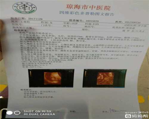 代孕的坏处_上海湘雅医院可以做供卵试管吗_国内做试管婴儿哪家好_国内哪家医