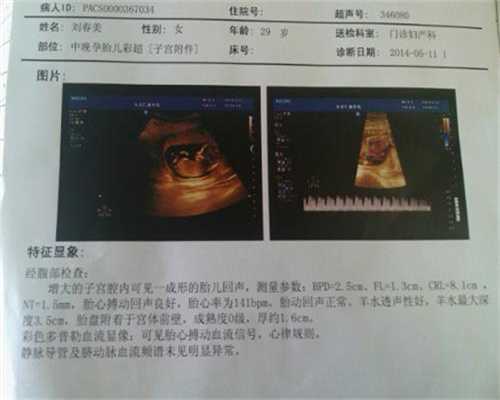 上海允许代孕吗_35周岁试管可