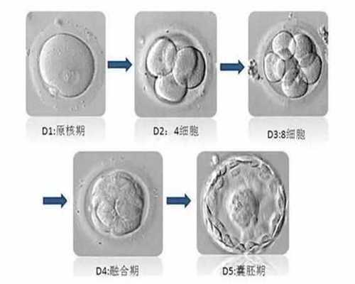那里做代孕好_50万找私人上海代孕2021_试管婴儿取卵的过程_试管婴儿取卵子过程