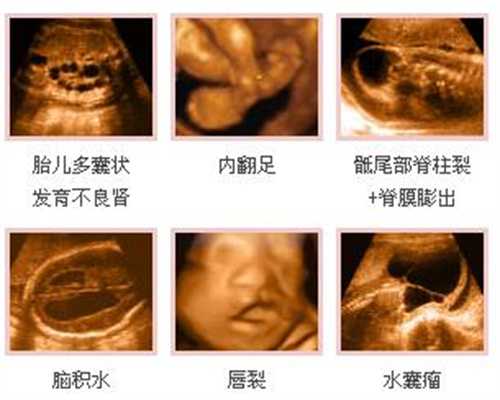 上海哪里有代妈_39岁取12个卵正常吗_试管婴儿是珍贵儿吗_泰国试管婴儿贵吗-