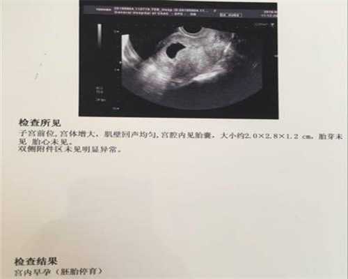 上海添喜代孕医院_44岁试管一次成功经验_试管对身体的伤害_做流产对身体的伤